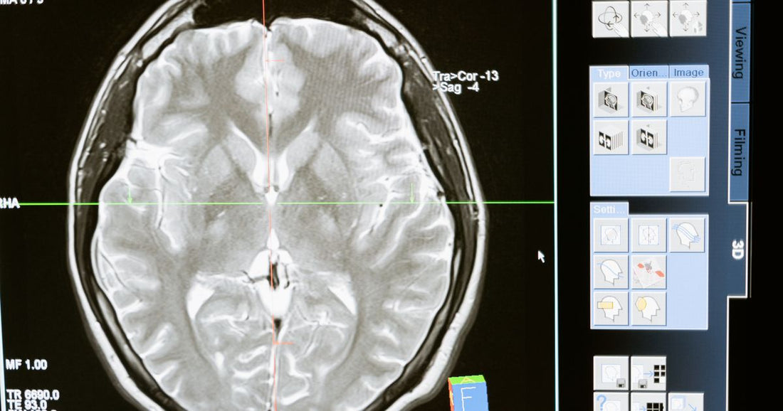 Best Car X-Ray Scanners 2026: Top Picks Ranked